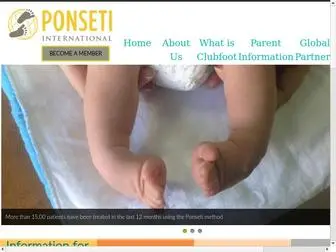 Ponseti.info(Ponseti info) Screenshot