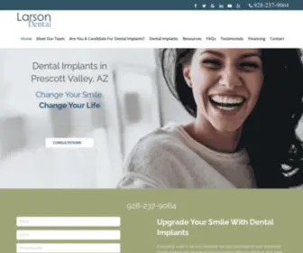 Prescottimplantdentist.com(Comfortable Implant Care in Prescott Valley) Screenshot