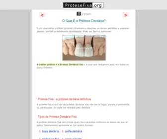 Protesefixa.org(Prótese Dentária Fixa é o melhor tipo de prótese) Screenshot