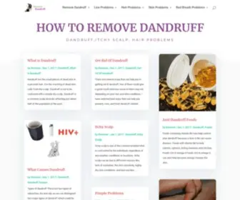 Removedandruff.com(Remove Dandruff) Screenshot