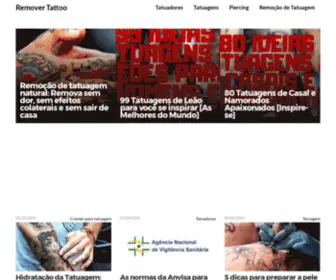 Removertattoo.com.br(Remoção de Tatuagem) Screenshot