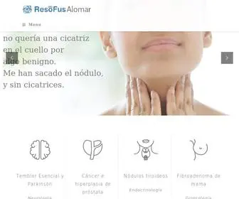 Resofusalomar.es(ResoFus Alomar) Screenshot