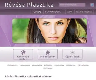 Reveszplasztika.hu(Révész Plasztika) Screenshot