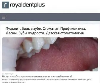 Royaldentplus.ru(Пульпит) Screenshot