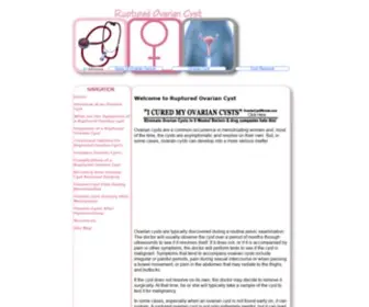 Rupturedovariancyst.com(Ruptured Ovarian Cyst) Screenshot