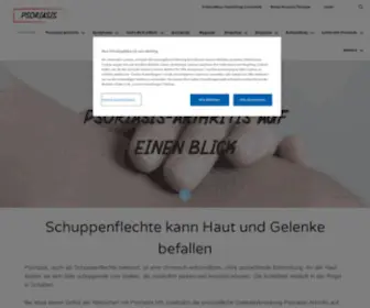 Schuppenflechte-Info.de(Schuppenflechte und psoriasis) Screenshot