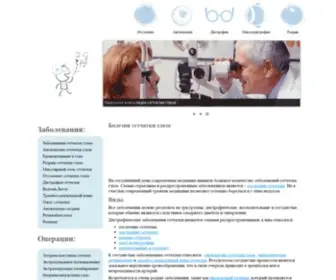 Setchatka-Glaza.ru(Заболевания сетчатки глаза) Screenshot