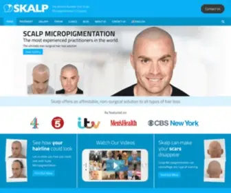 Skalp.com(The World's Number One Scalp Micropigmentation Company) Screenshot