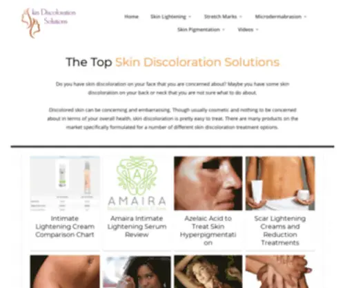 Skindiscolorationsolutions.org(Skin discoloration) Screenshot