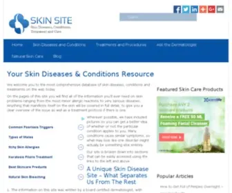 Skinsite.com(#1 Skin Diseases) Screenshot