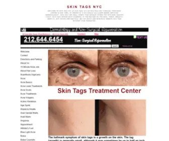 Skintagsnyc.org(Skin Tags NYC) Screenshot