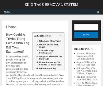 Skintagsremovalsystem.com(Hippie Skin) Screenshot