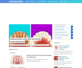 Soindentaire.com(Soins dentaires) Screenshot