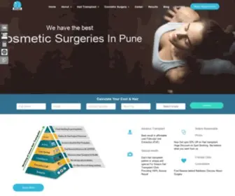 Solacehairindia.com(Best Hair Transplant in Pune) Screenshot