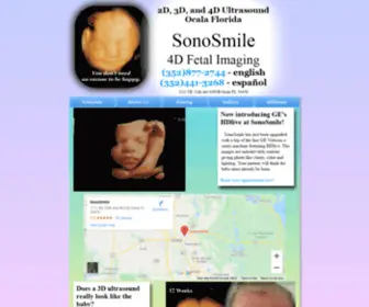 Sonosmile.com(3D Ultrasound Ocala) Screenshot