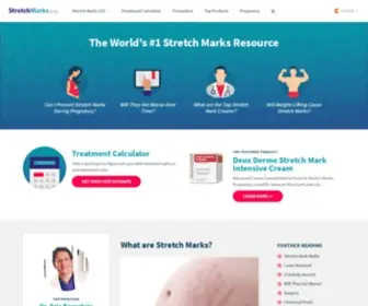 Stretchmarks.org(Treatments, Causes and Prevention) Screenshot