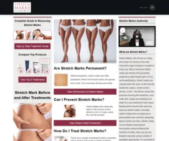 Stretchmarksauthority.com(Stretch Marks Authority) Screenshot