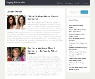 Surgerybeforeafter.com(Celebrity plastic surgery) Screenshot