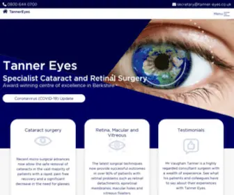 Tanner-Eyes.co.uk(Tanner Eyes) Screenshot