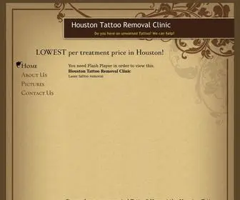 Tattooremovalofhouston.com(Houston Tattoo Removal Clinic) Screenshot