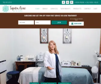 Topekaacneskincare.com(Topeka Acne Skin Care & Day Spa) Screenshot