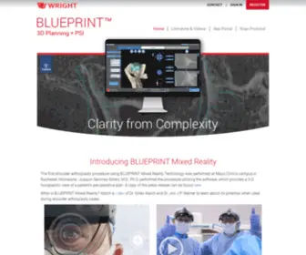 Tornierblueprint.com(Surgeon Controlled 3D Planning Software) Screenshot