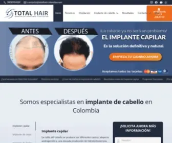 Totalhaircolombia.com(Implante de cabello 10% de descuento) Screenshot