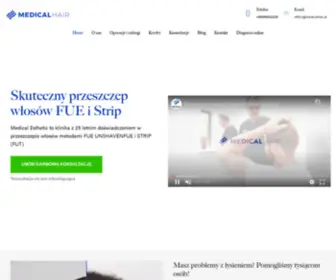 TransplantacJawlosow.pl(łysienie) Screenshot