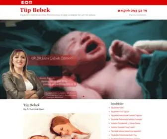 Tupbebek1.com(Tüp Bebek) Screenshot