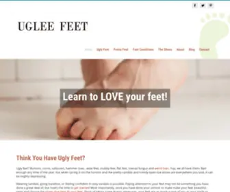 Ugleefeet.com(How To Deal With Corns) Screenshot