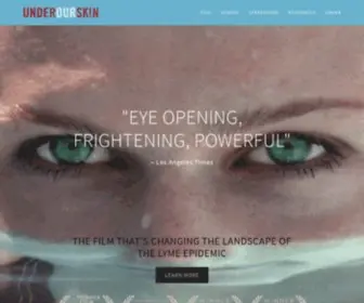 Underourskin.com(Under Our Skin) Screenshot