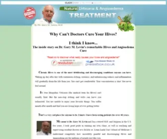 Urticariahivestreatment.com(Natural Urticaria (Hives) & Angioedema Treatment By Dr) Screenshot