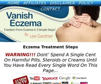 Vanisheczema.com(Vanish Eczema by Lee Gardner) Screenshot