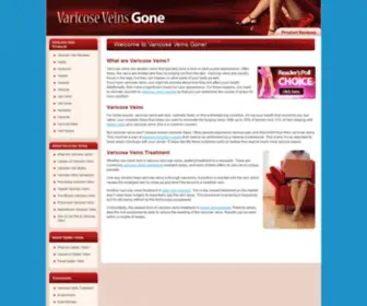 Varicoseveinsgone.com(Varicose Veins Treatment) Screenshot