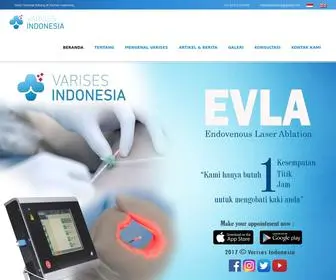 Varisesindonesia.id(Varises Indonesia) Screenshot