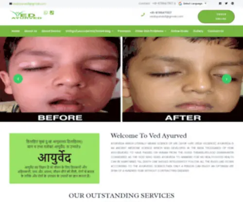 Vedayurved.in(Ved Ayurved Clinic) Screenshot