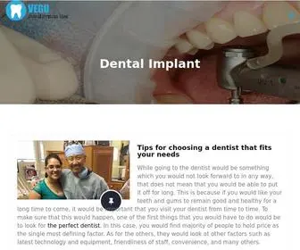 Vegu.tv(Dental Implant Surgery) Screenshot