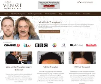 Vincihairtransplant.com(Vinci Hair Transplant) Screenshot