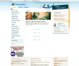 Virusova-Hepatitida.sk(Virusová žltačka) Screenshot