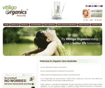 Vitiligoorganics.com(Vitiligo Organics) Screenshot