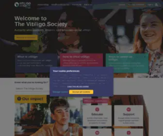 Vitiligosociety.com(The Vitiligo Society) Screenshot