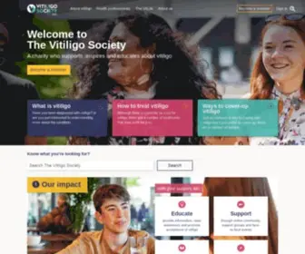 Vitiligosociety.org(The Vitiligo Society) Screenshot