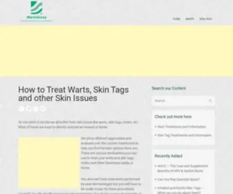 Wartalooza.com(How to Treat Warts) Screenshot