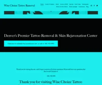 Wisechoicetattooremoval.com(Wise Choice Tattoo Removal) Screenshot