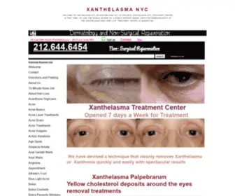 Xanthelasmanyc.org(Xanthelasma NYC) Screenshot