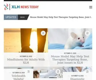 XLhnewstoday.com(XLH News Today Home) Screenshot