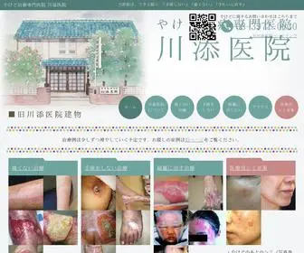 Yakedo.com(やけど治療専門医院) Screenshot