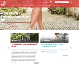 Zilniporadna.cz(Žilní poradna) Screenshot