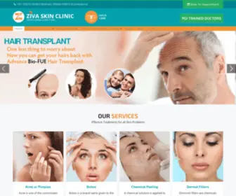 Zivaskinclinic.com(Skin clinic in Mohali) Screenshot