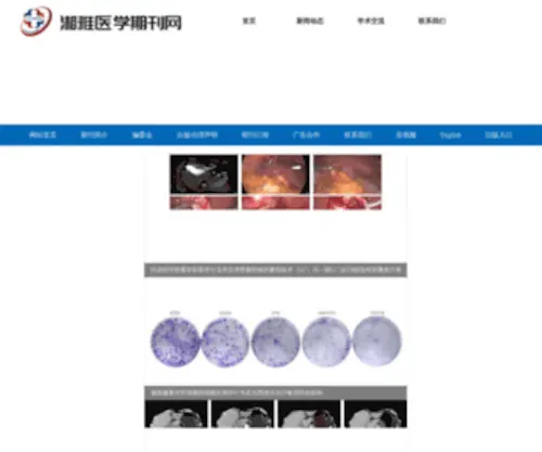 ZPWZ.net(欢迎访问《中国普通外科杂志》编辑部) Screenshot
